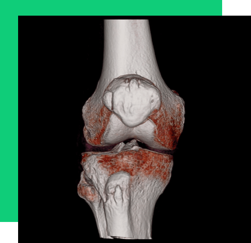 knee3d